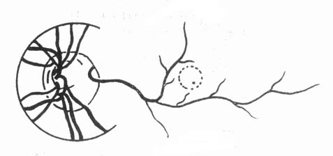 ��״����Ĥ����