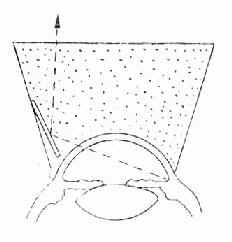 ��ӷ��Ǿ�������ʽ��