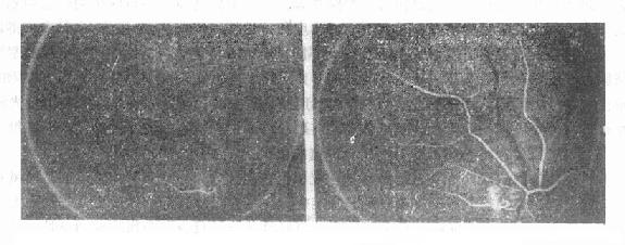 ��������ӫ����Ӱ����ʾ����Ĥ��״Ѫ�ܶ�����