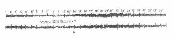 ����EOGͼ��