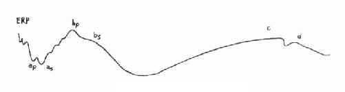 ERG�ɷ�ʾ��ͼ