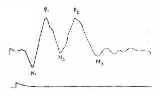 ����VEP�Ļ�������