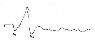 ͼ��VEP�Ļ�������