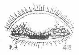 ɳ�۵���ͷ������