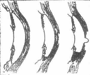 ��Ĥ����