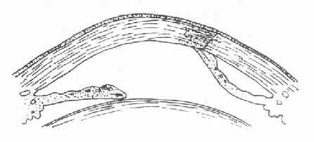 ճ���Խ�Ĥ�װ�