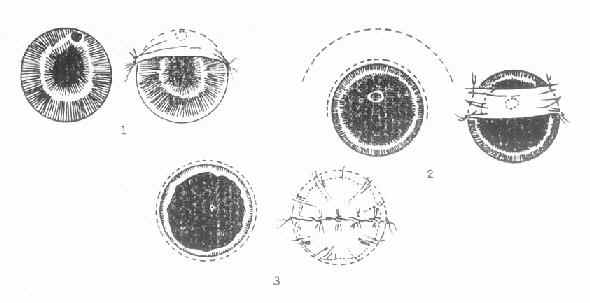 ���ֲ�ͬ��λ�Ľ�Ĥ���񣬲�ȡ��ͬ�Ľ�Ĥ���ڸǷ�