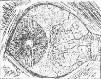 �����Ա��㹮Ĥ��