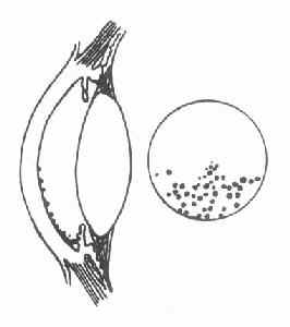 ��Ĥ�������