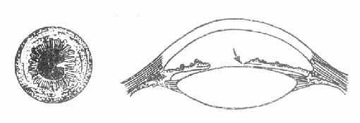 ���ֺ�Ĥ��ճ��