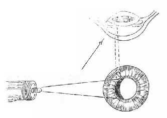 ��ĤͶӰ���