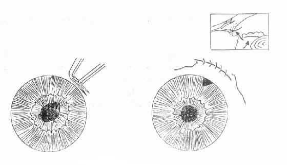 �ܱߺ�Ĥ�г���