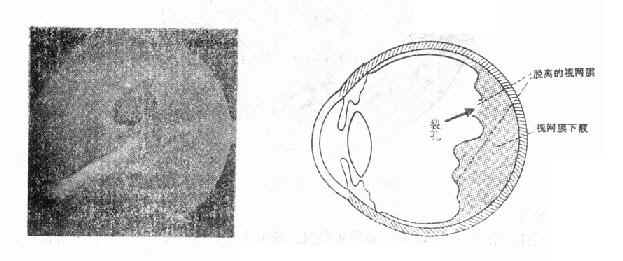 ����Ĥ����