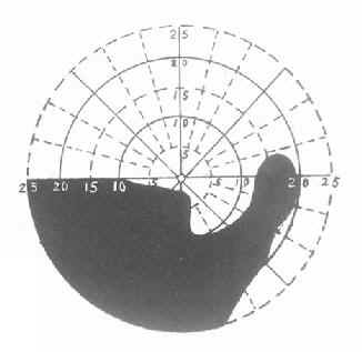 ȱѪ������ͷ�������Ұ�ı�