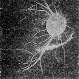 ����Ĥ����