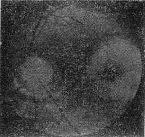 �ư�������Ĥ��Ѫ��