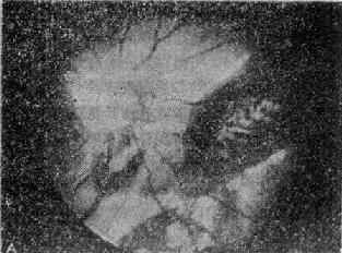 ����������Ĥ������Ĥ��<a href=