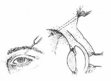 ���򴩿���