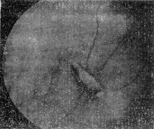 ����Ĥǰ����