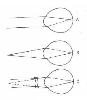 �����۵�����״̬������ԭ��