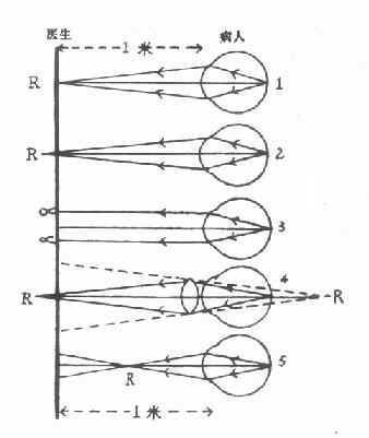 ��Ӱ���ԭ��