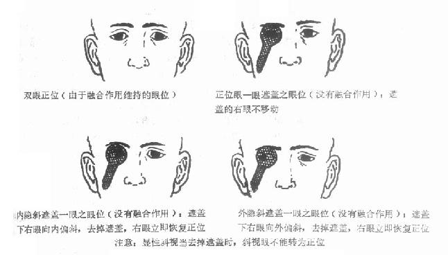 ��λ������б����һ�۱��ڸ�ʱ�ı���