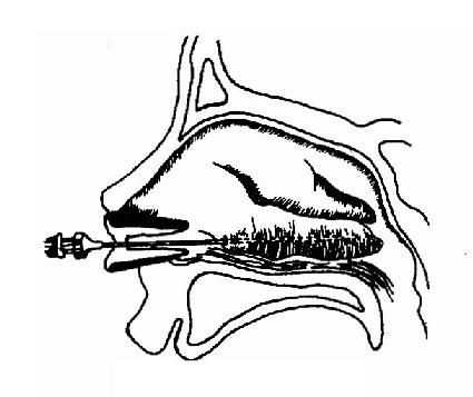 �±Ǽ�Ӳ����ע�䷨