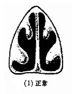 ���и�ƫ��������