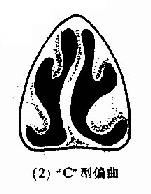 ���и�ƫ��������