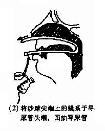 ��ǿ�������