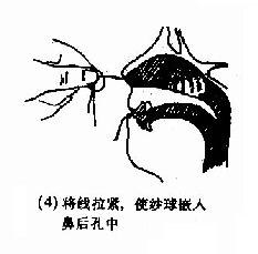 ��ǿ�������