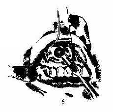 ��������� 5.��¶�����ѣ��俪ǰ�ڹ���