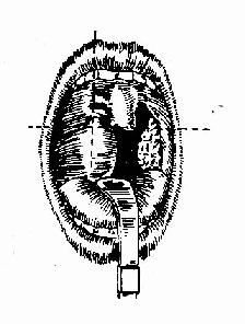 ��������Χŧ���п���λ��ͼ