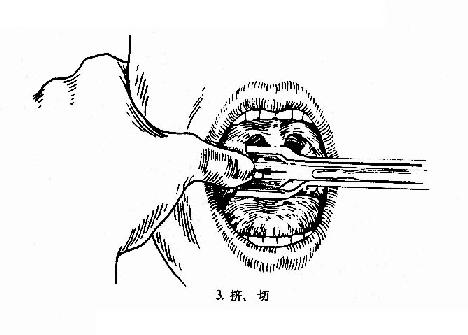 �����強����