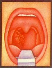 ��������<a href=