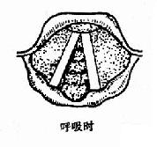 ��������̱��