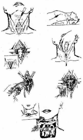 �����п���