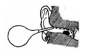 �������ϴ��