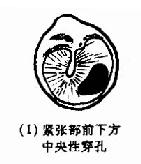 ��Ĥ��������