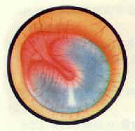 �����ж��׹�Ĥ��Ѫ