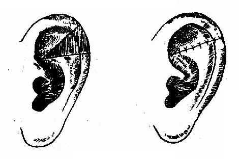 �������˵ķ��